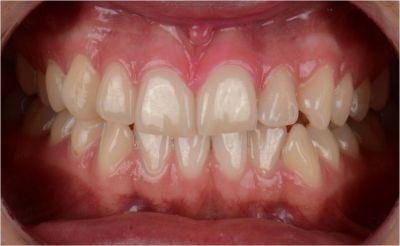 Notre zone d'activité pour ce service Cabinet dentaire Maupassant