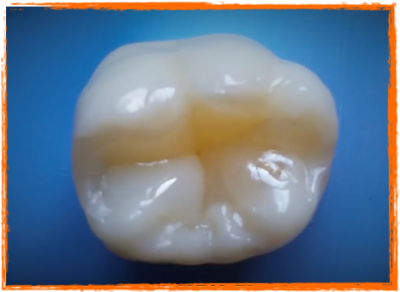 Notre zone d'activité pour ce service Pose de couronnes dentaires