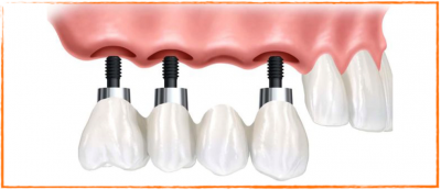 Nos prestations sur le secteur de Marseille Prado