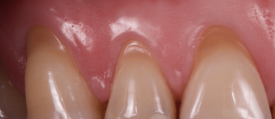 Notre zone d'activité pour ce service Pose de prothèse de dent en stellite