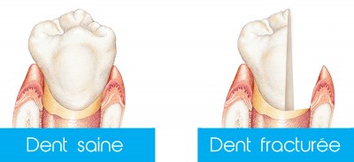 Nos prestations sur le secteur de La Rouvière Marseille