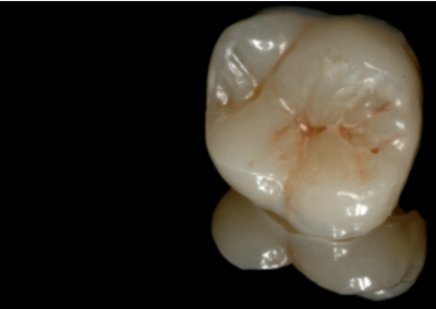 Nos prestations sur le secteur de Marseille Saint-Giniez