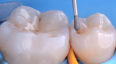 Nos prestations sur le secteur de Marseille Saint-Giniez