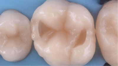 Nos prestations sur le secteur de Marseille Sainte-Anne 13008