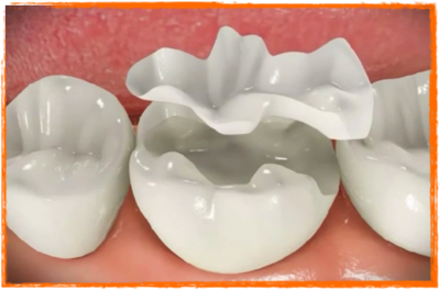 Nos prestations sur le secteur de Marseille Mazargues 13009