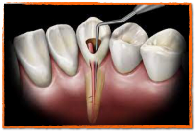 Notre zone d'activité pour ce service Dentiste pour réalisation de surfaçage dentaire