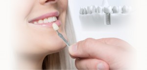 Notre zone d'activité pour ce service Dentiste pour réalisation de surfaçage dentaire