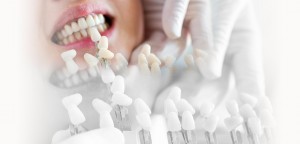 Notre zone d'activité pour ce service Pose de couronnes dentaires